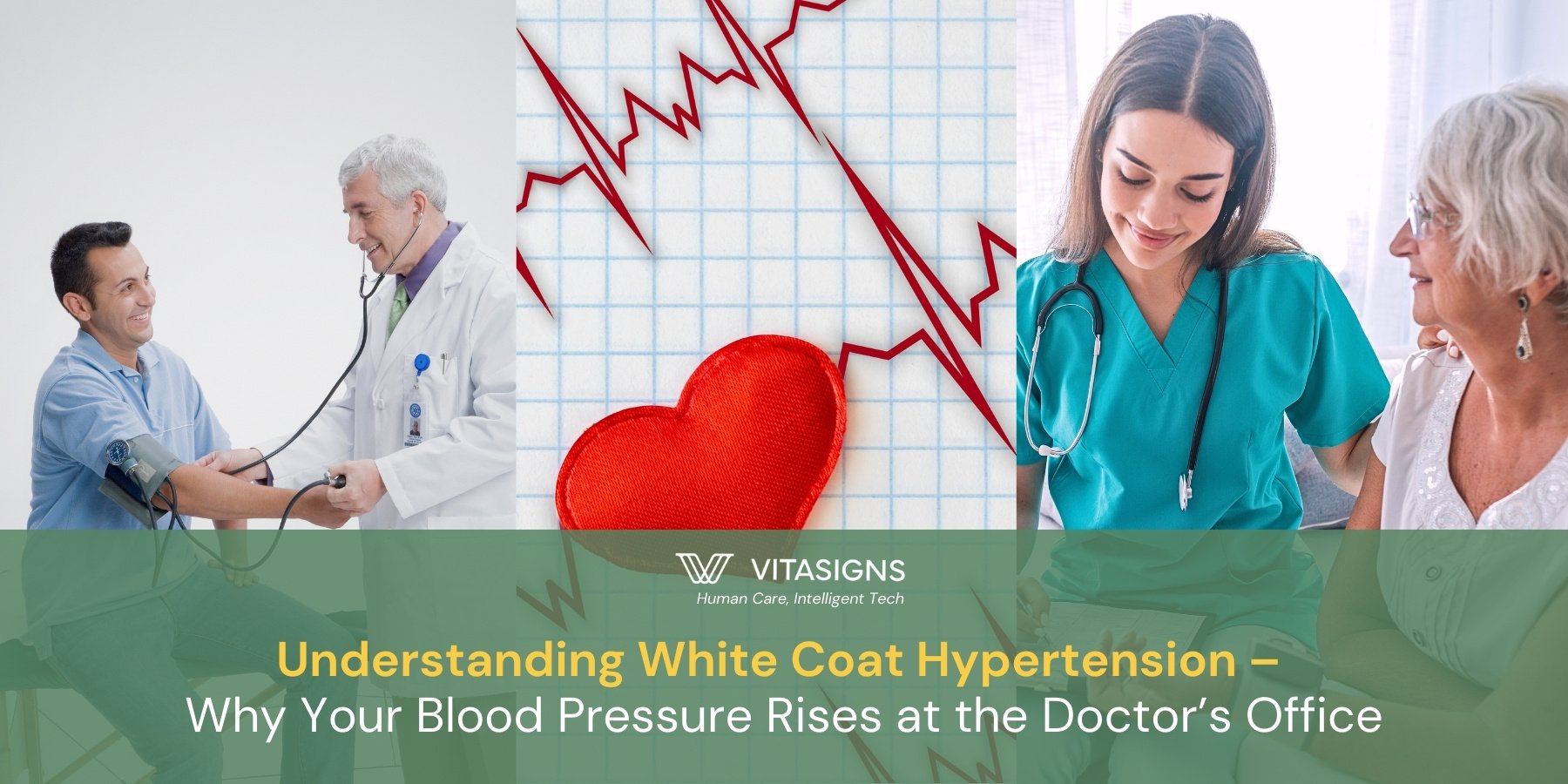 Understanding White Coat Hypertension – Why Your Blood Pressure Rises at the Doctor’s Office